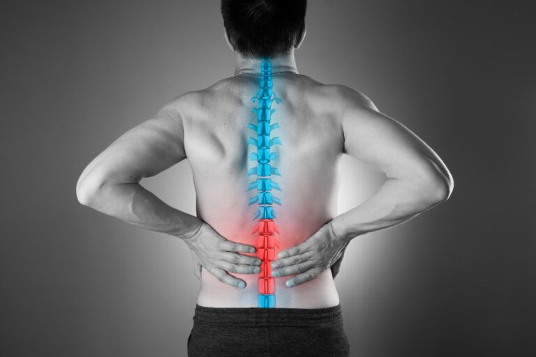 Arthritic Back Pain