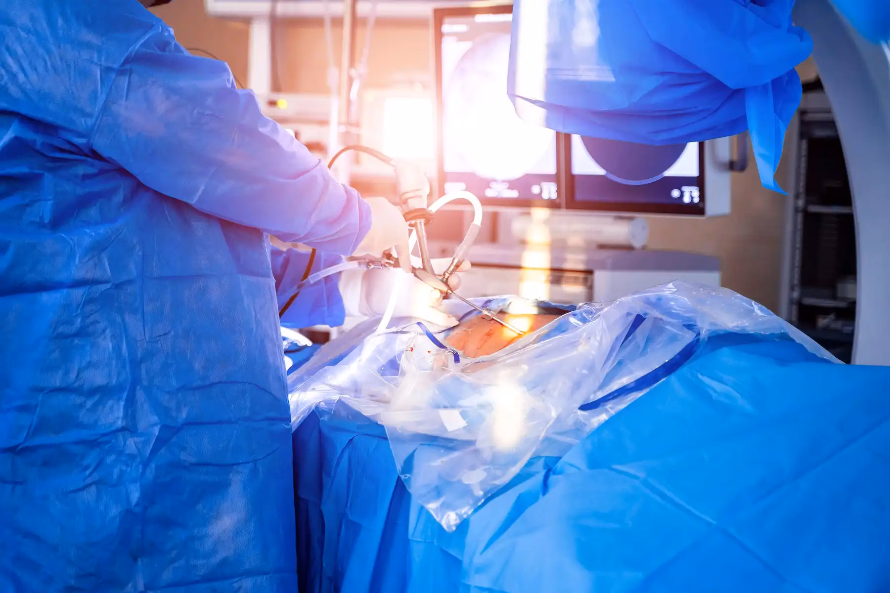 lumbar laminectomy