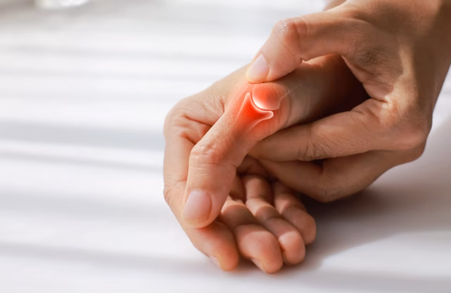 Thumb Arthritis