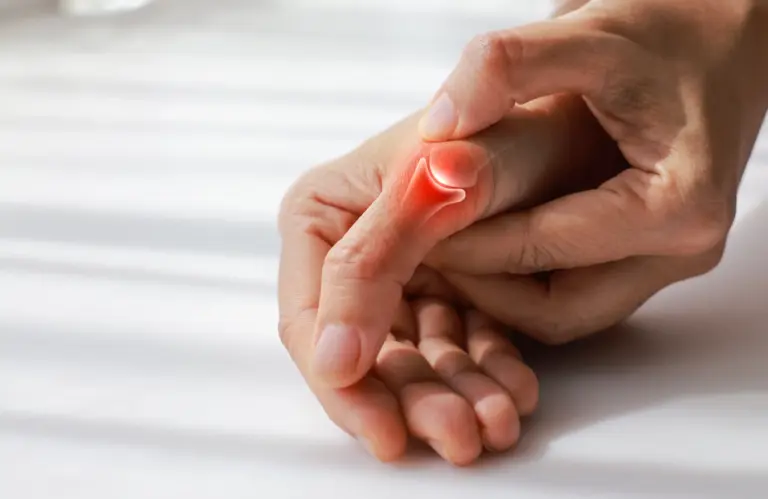 Thumb Arthritis