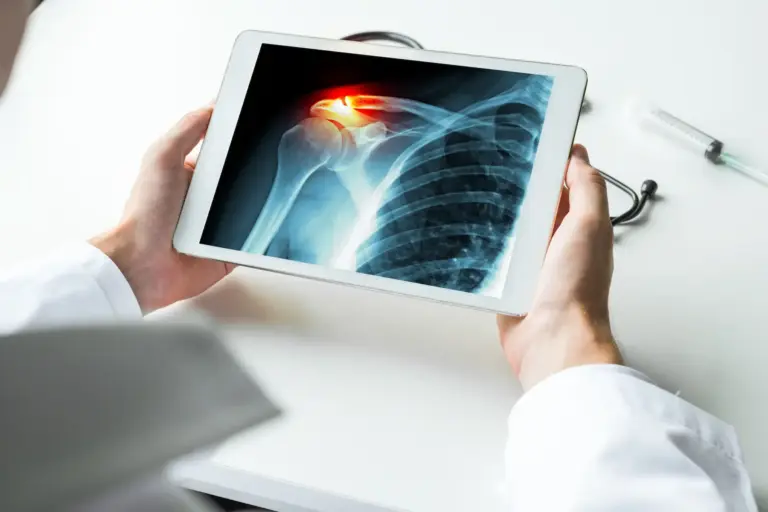 AC Joint Separation
