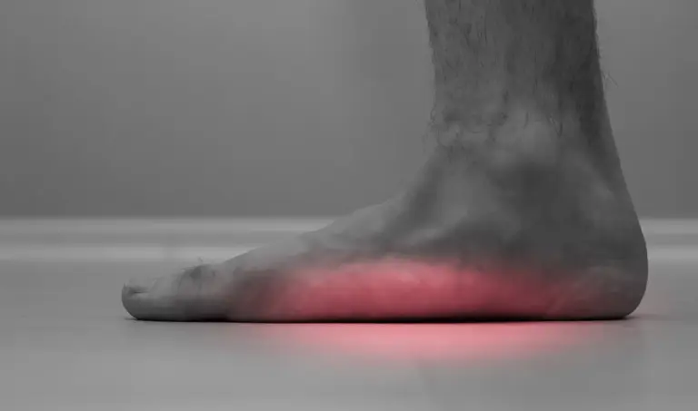 Flatfoot