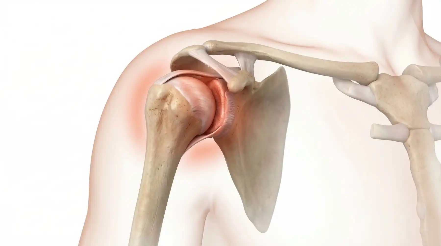 Frozen Shoulder