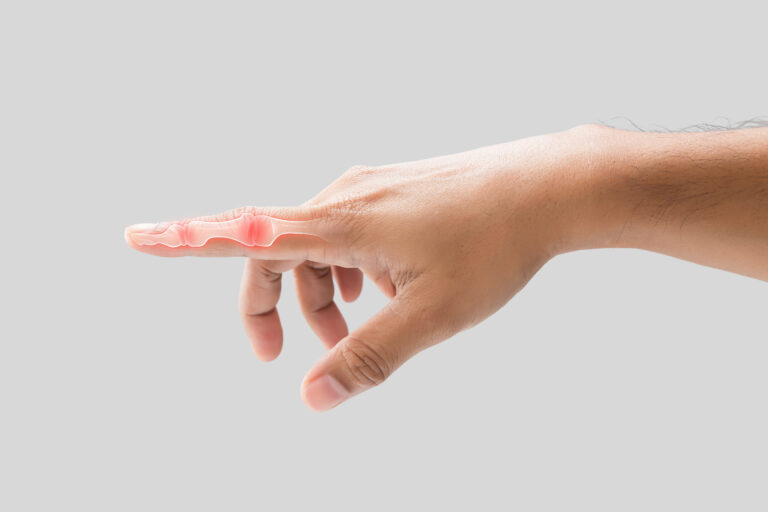 Trigger Finger
