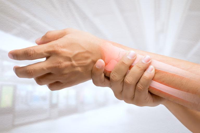 Wrist Fracture