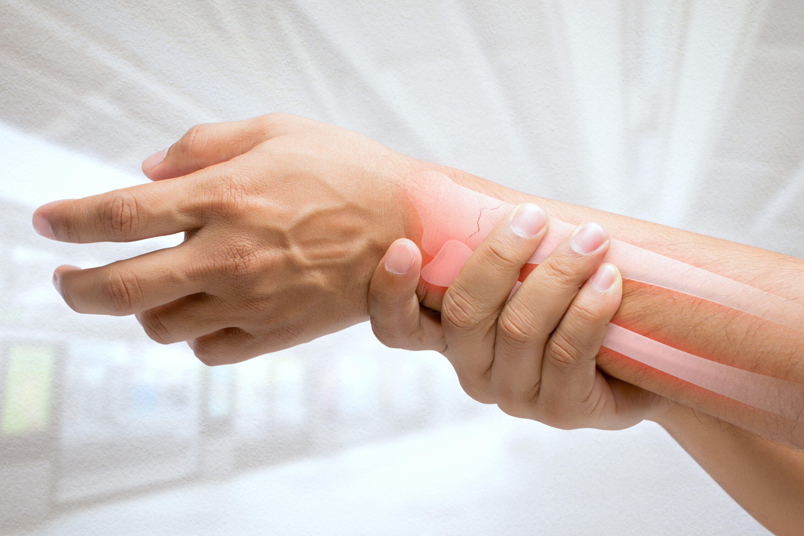 Wrist Fracture