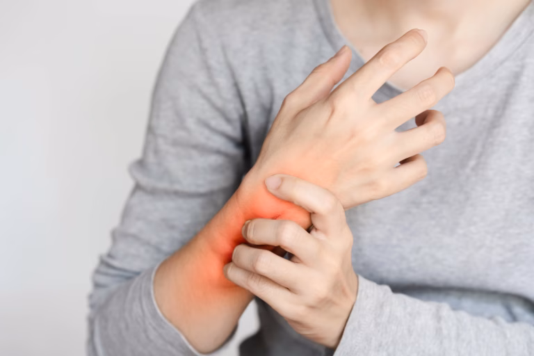 Wrist Sprain