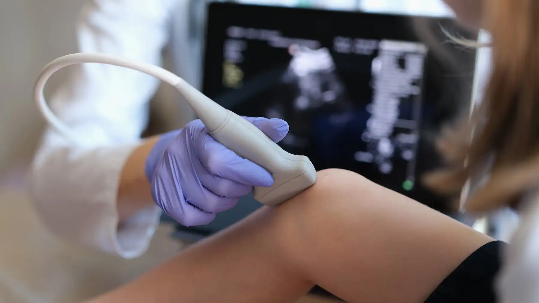 Ultrasound